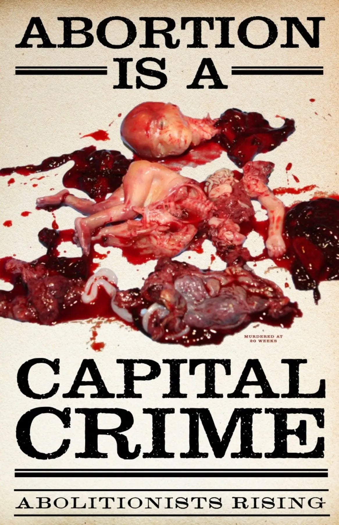 Abortion Is A Capital Crime Sign Abolitionists Rising Store
