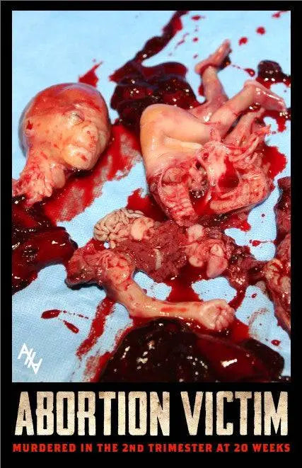 Abo. Victim 2nd Trimester 20 Weeks Sign - Abolitionists Rising Gear Store Signs Default Title Abolitionists Rising Store