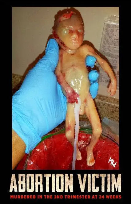 Abo. Victim 2nd Trimester 24 Weeks Sign - Abolitionists Rising Gear Store Signs Default Title Abolitionists Rising Store