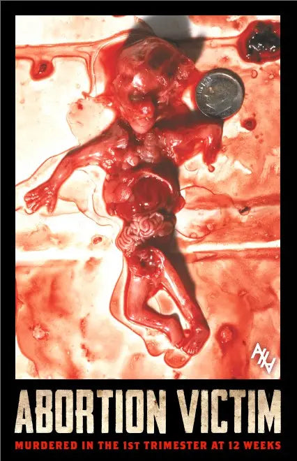 Abo. Victim 1st Trimester-12 Weeks Sign - Abolitionists Rising Gear Store