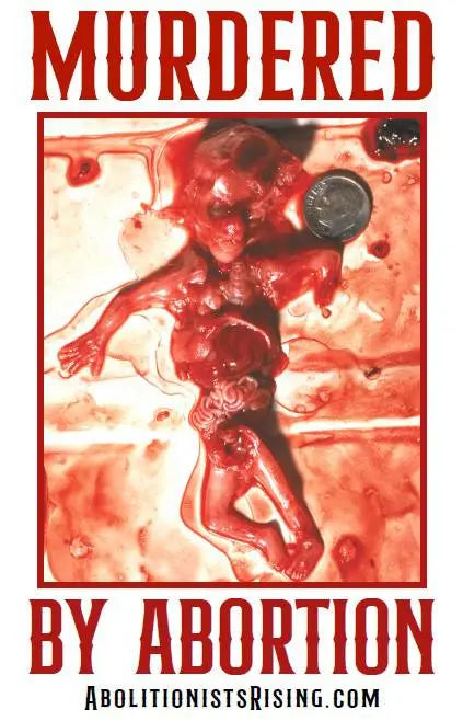 Abo. Victim Murdered By Abortion Sign - Abolitionists Rising Gear Store Signs Default Title Abolitionists Rising Store