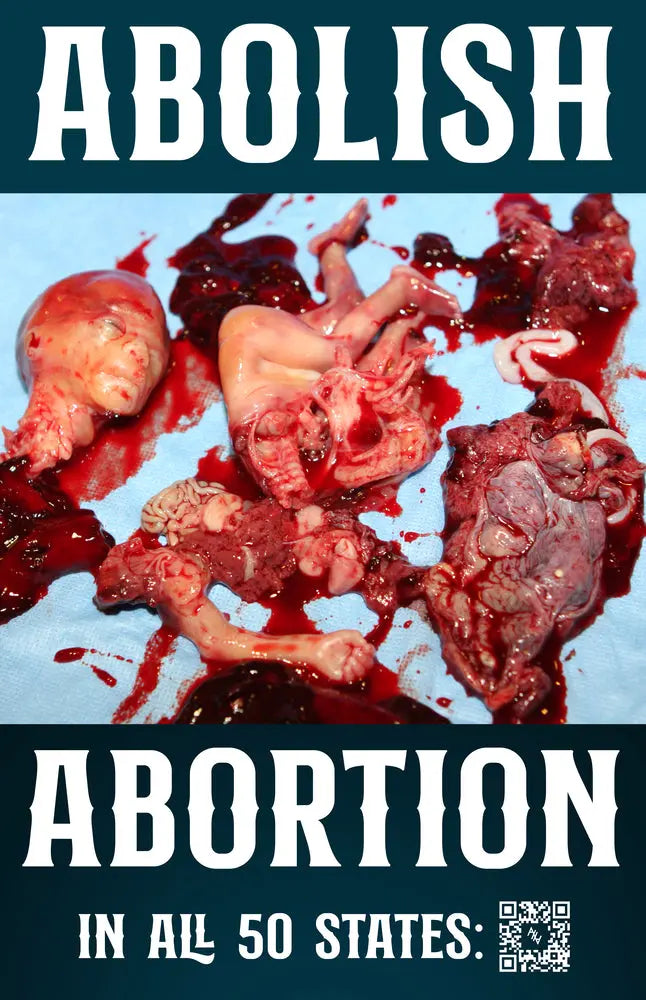 Abolish Abortion In All 50 States Sign 3 - Abolitionists Rising Gear Store