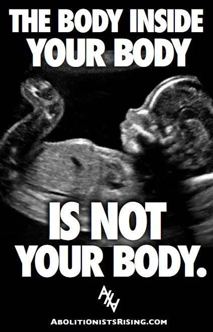 The Body Inside Your Body Sign - Abolitionists Rising Gear Store Signs Default Title Abolitionists Rising Store