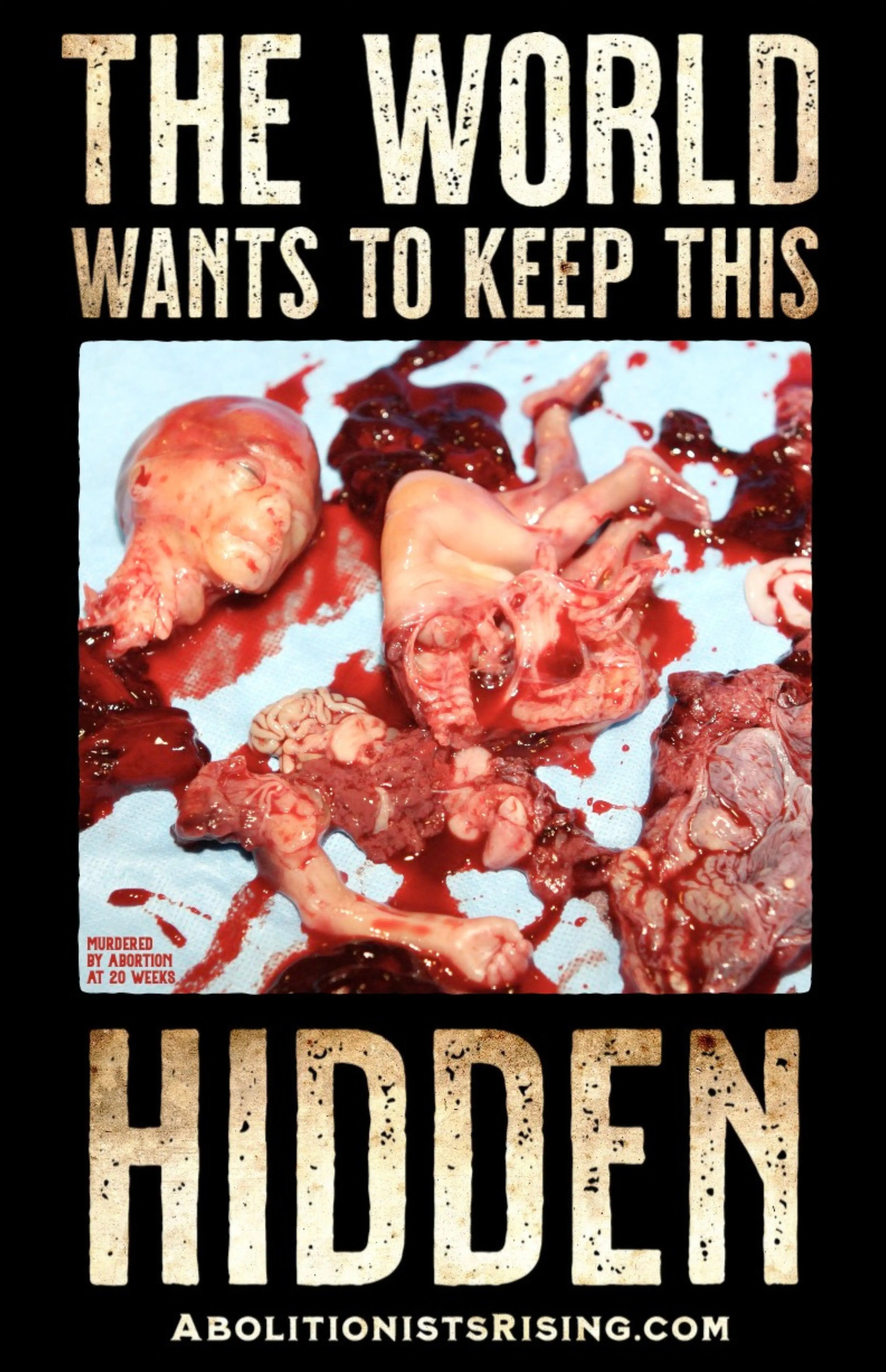 The World Wants to Keep This Hidden Sign Abolitionists Rising Store