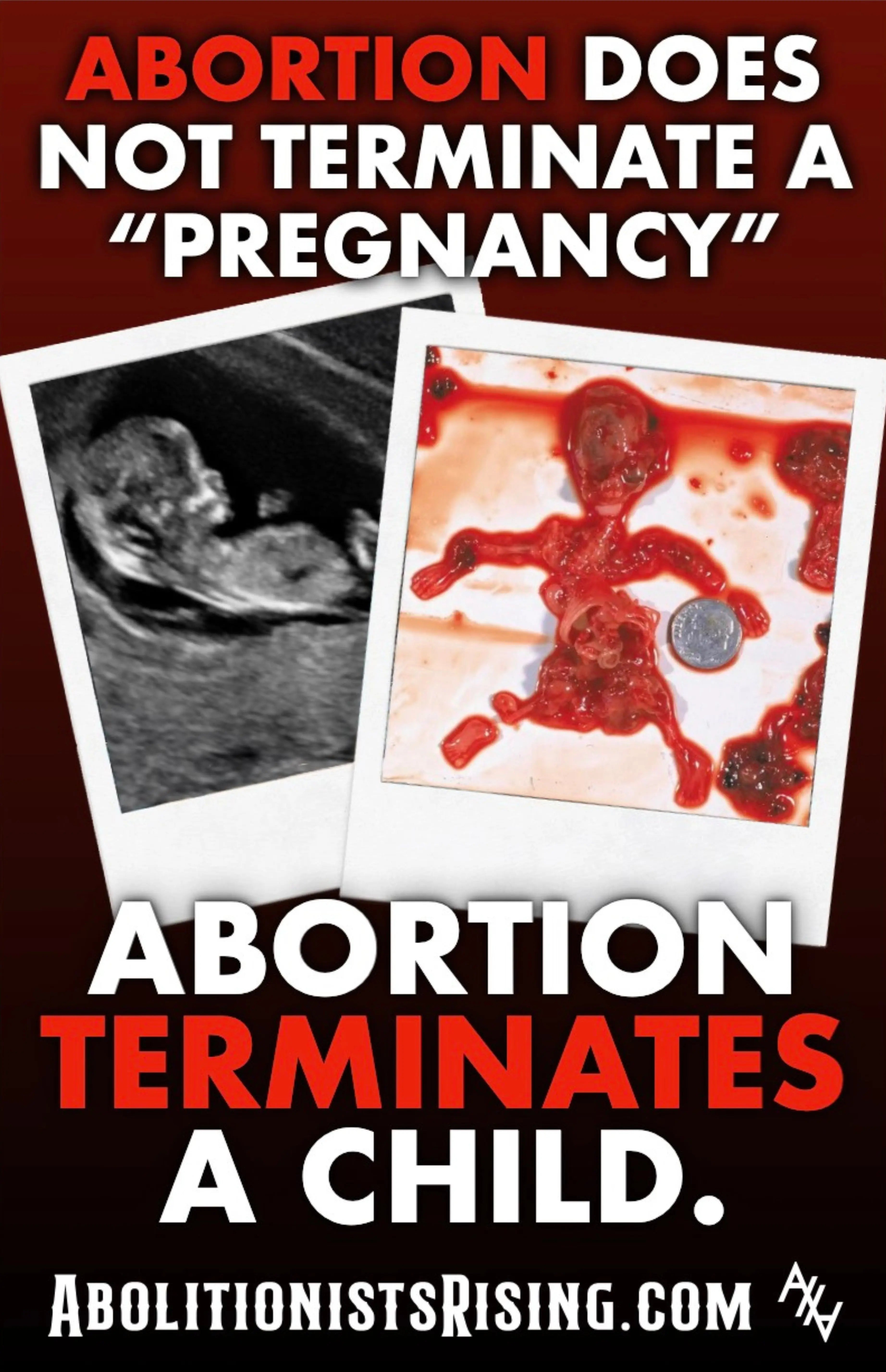 Terminates A Child Sign Abolitionists Rising Store