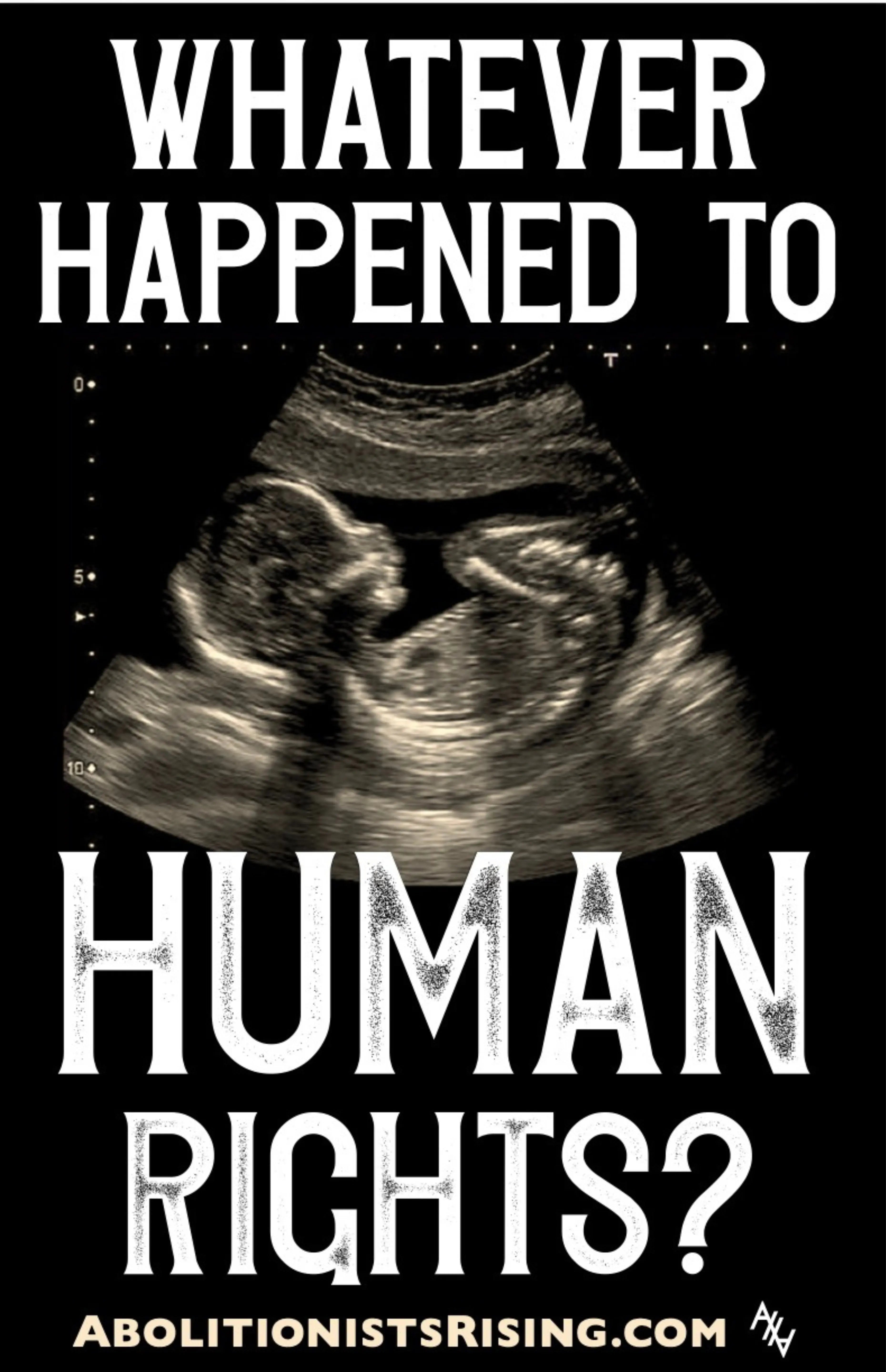 Whatever Happened to Human Rights Sign Abolitionists Rising Store