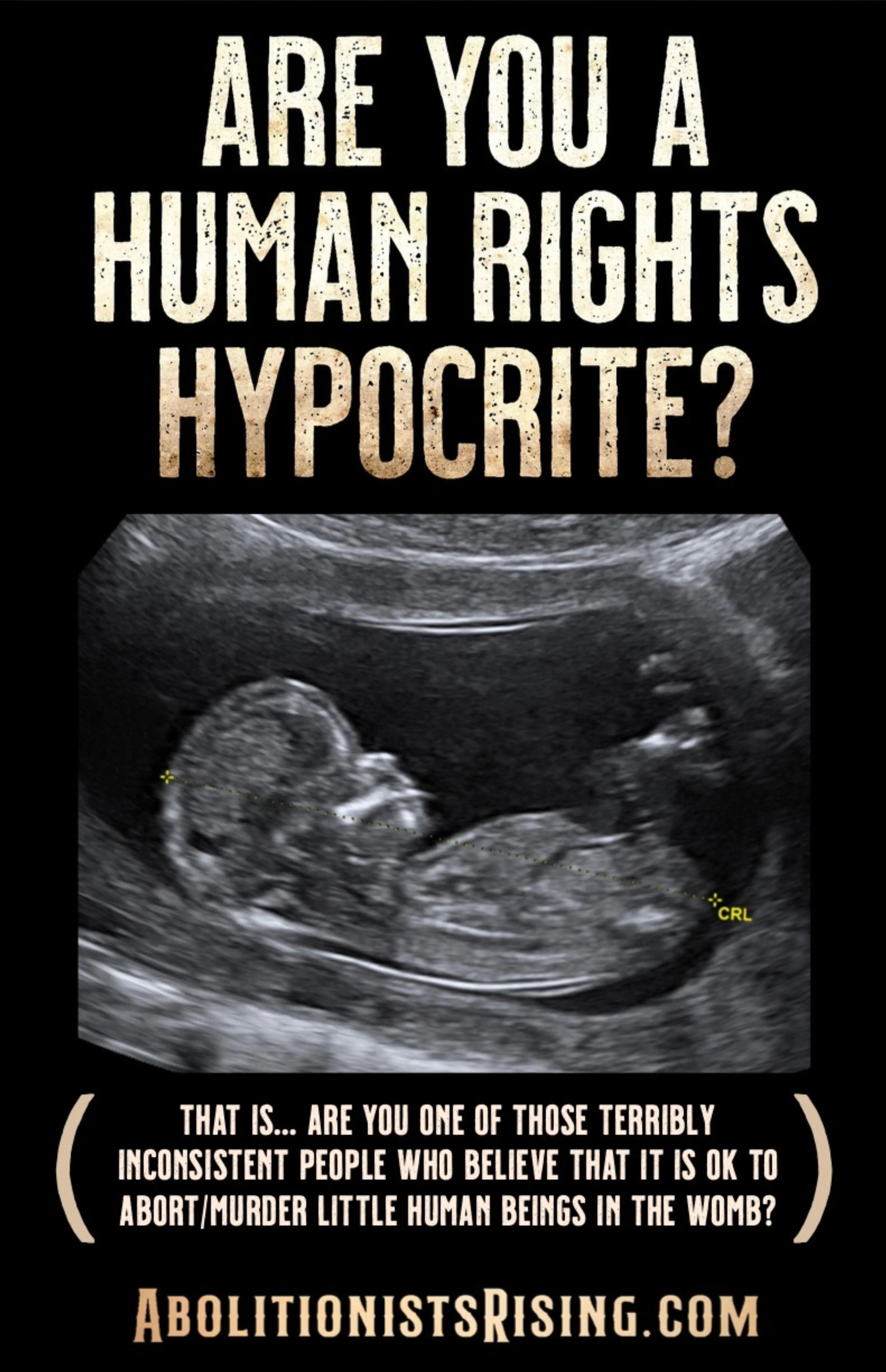 Human Rights Hypocrite Sign Abolitionists Rising Store