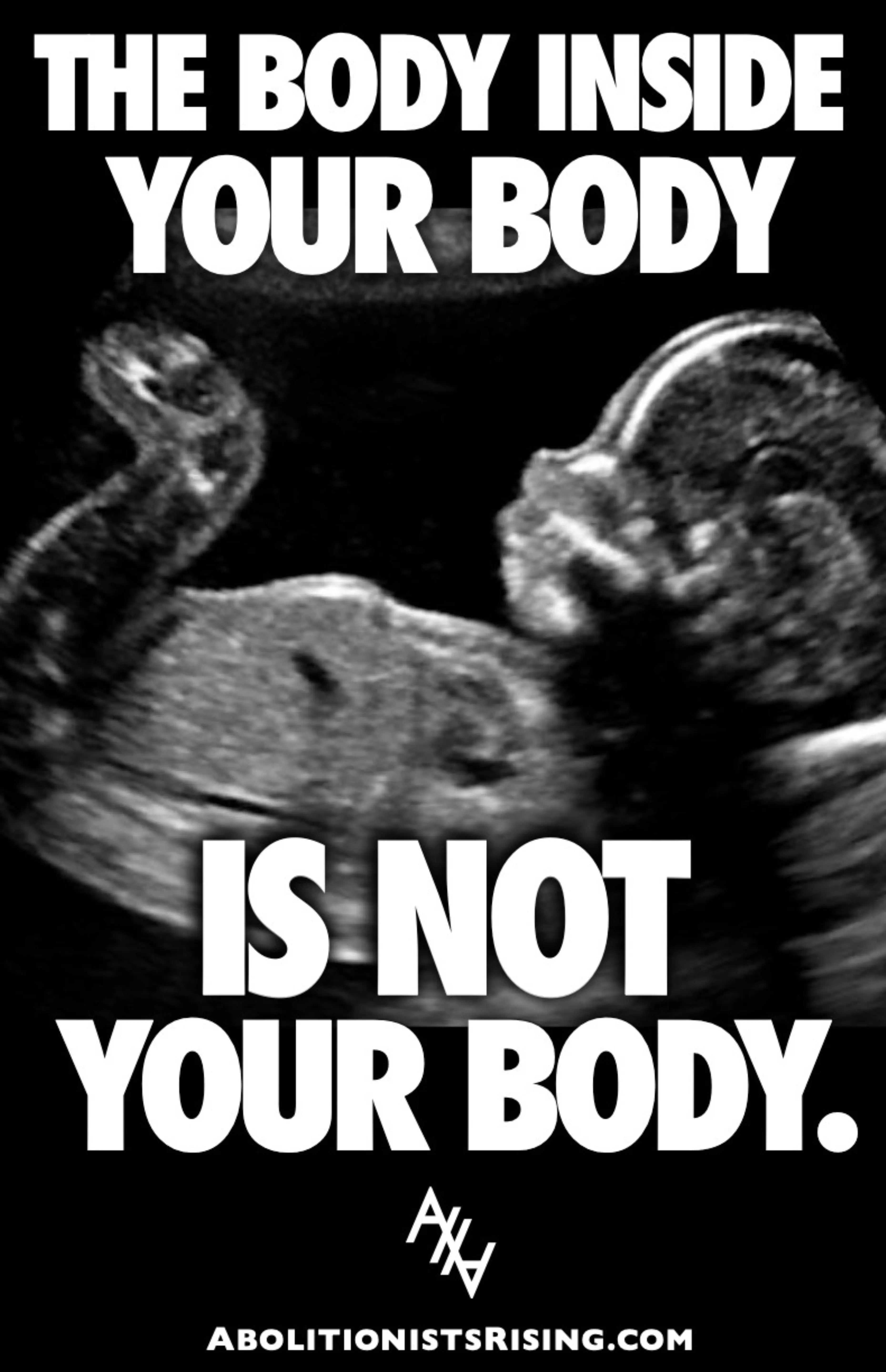 The Body Inside Your Body Sign Abolitionists Rising Store