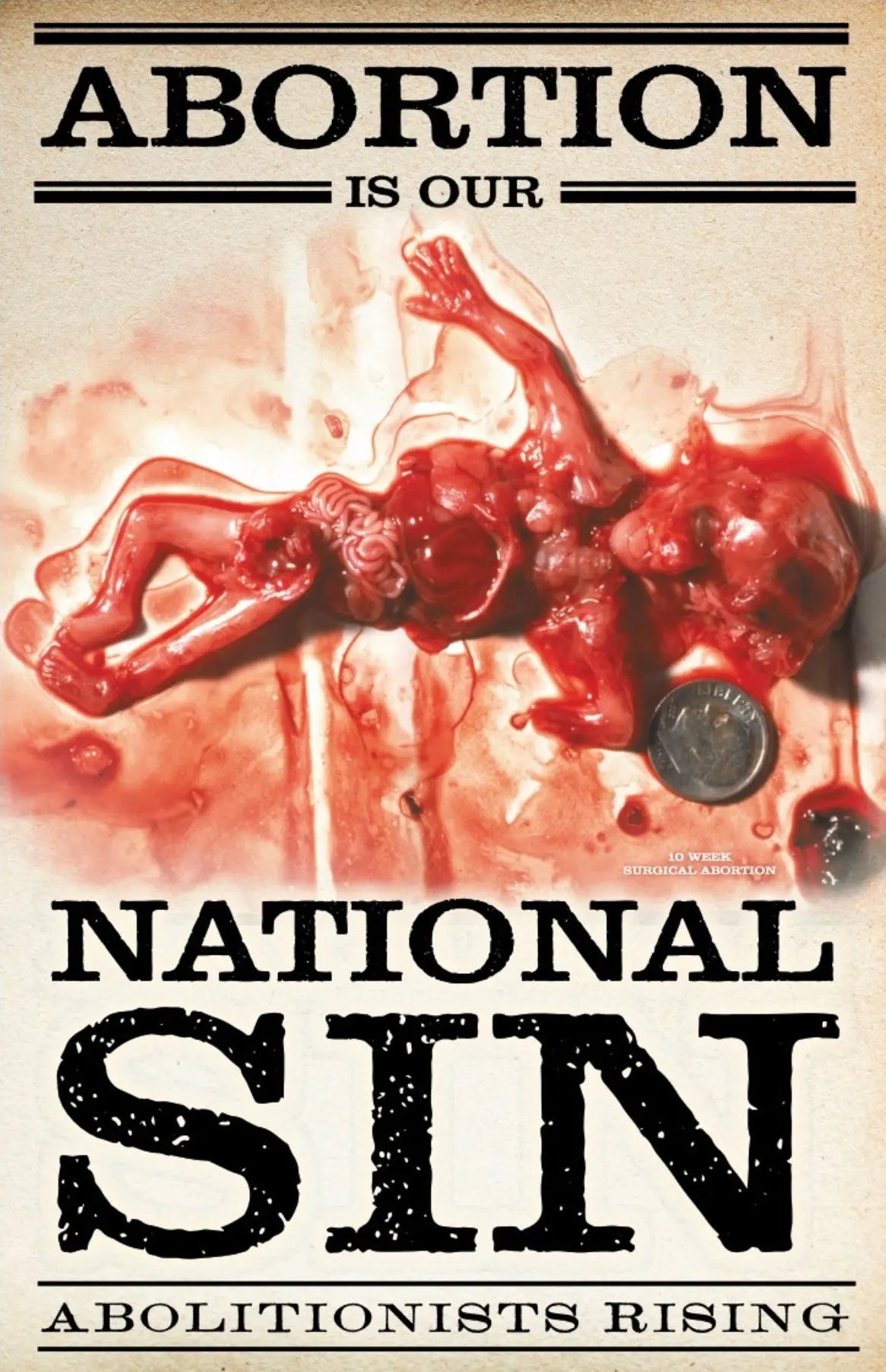 Abortion Is Our National Sin Sign Abolitionists Rising Store 