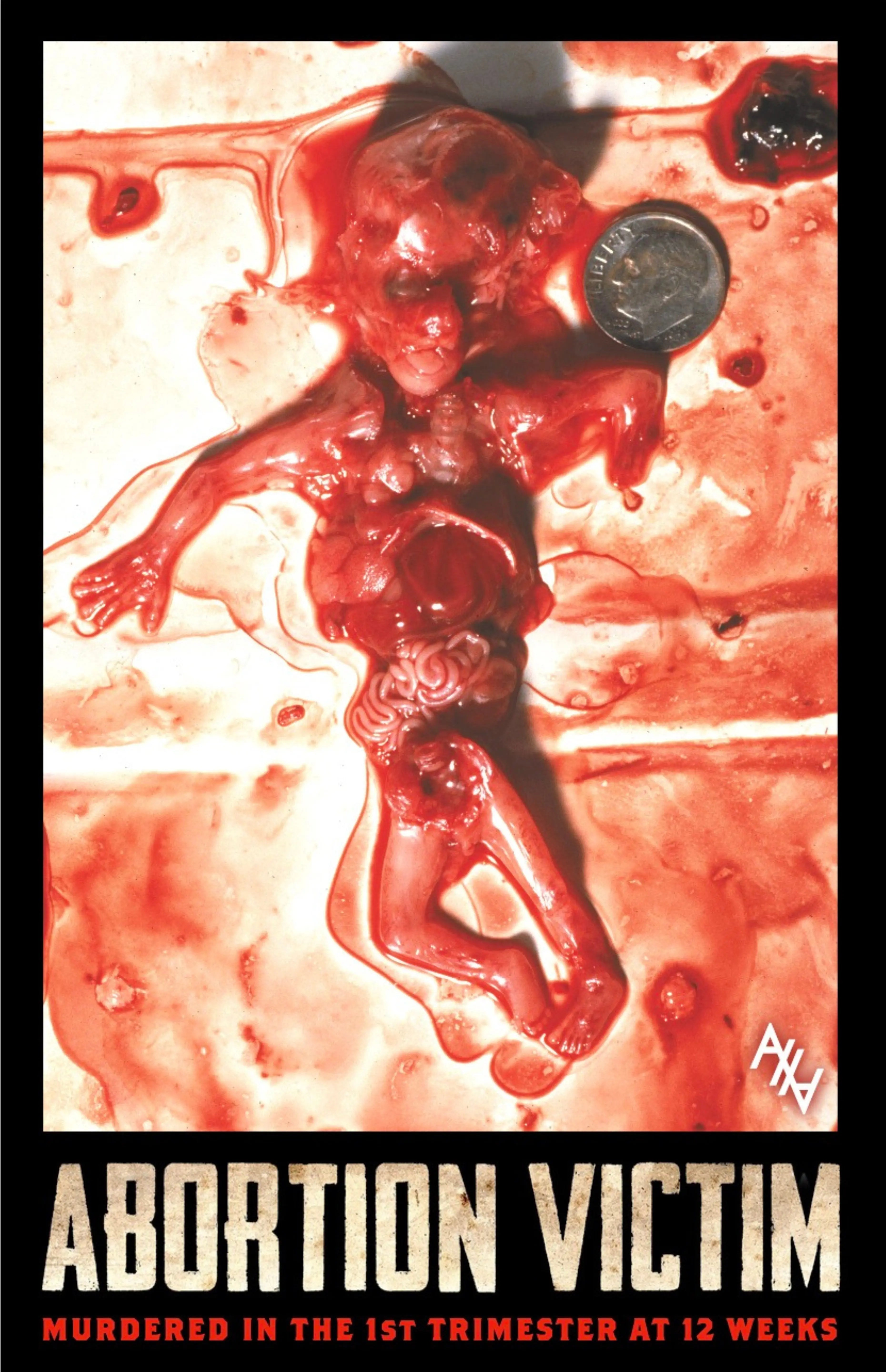 Abo. Victim 1st Trimester-12 Weeks Sign Abolitionists Rising Store 