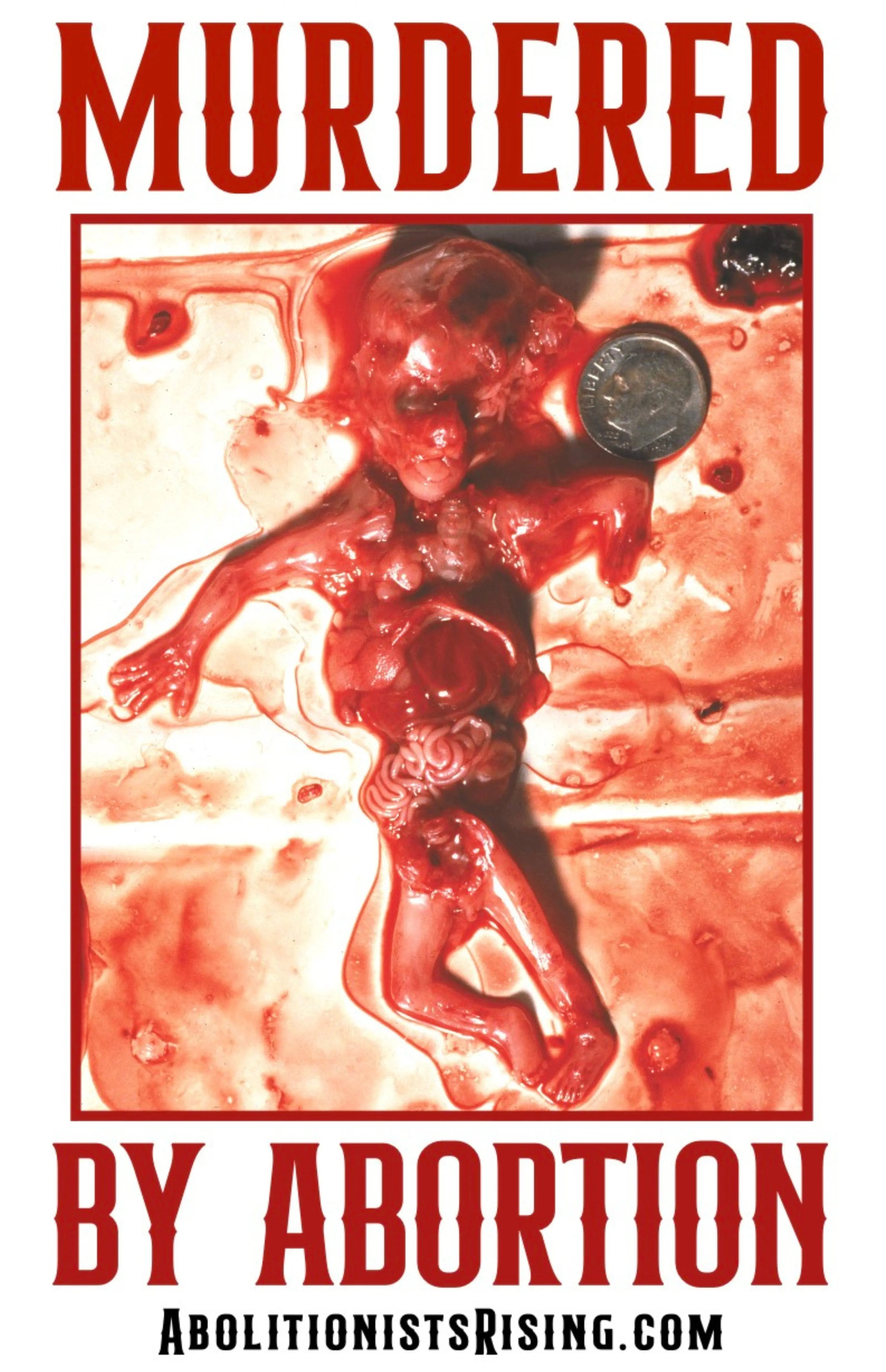 Abo. Victim Murdered By Abortion Sign Abolitionists Rising Store 