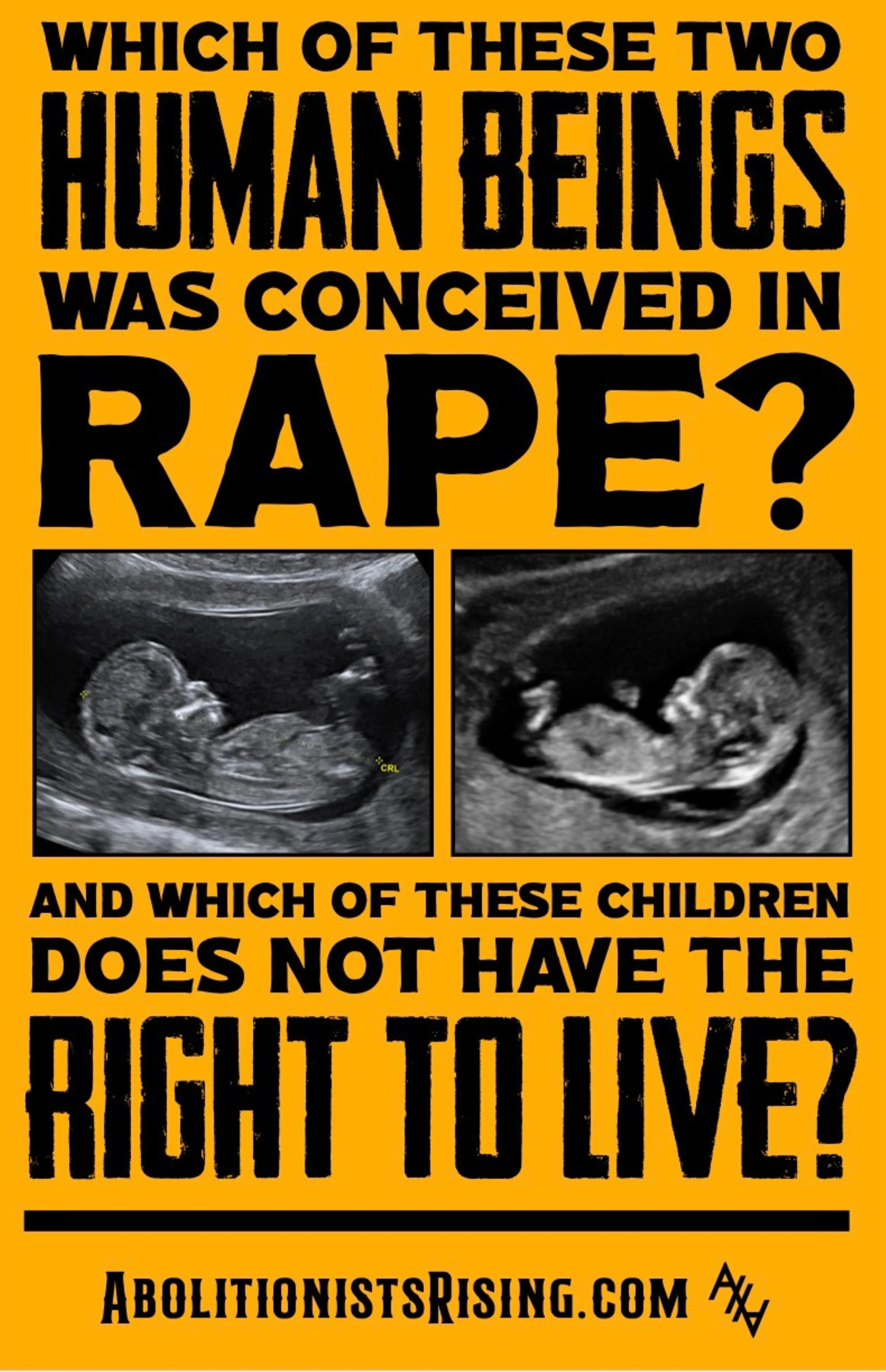 Which of These Two Human Beings? Sign Abolitionists Rising Store 