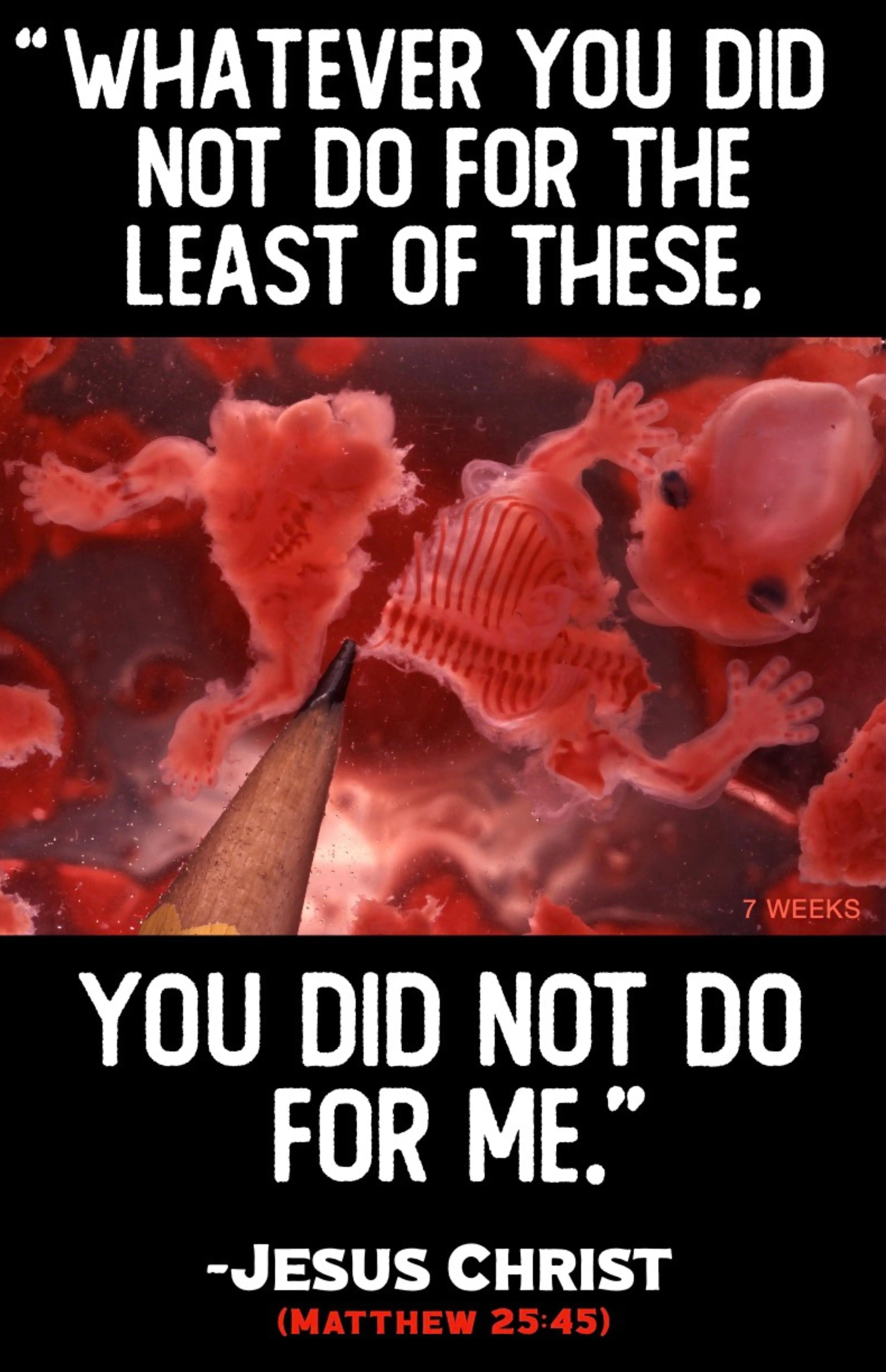 Whatever You Did Not Do For The Least of These Sign Abolitionists Rising Store 