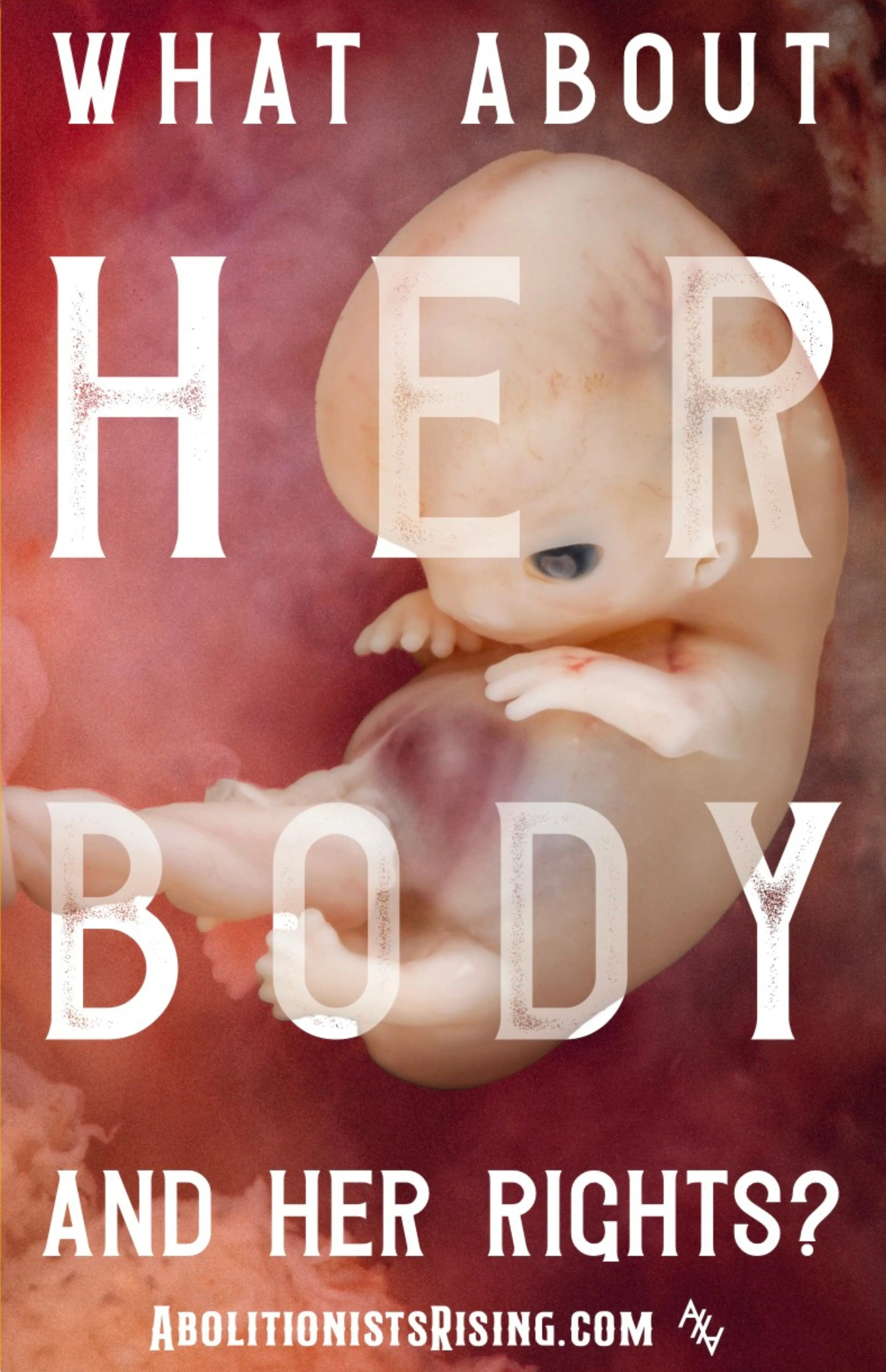 What About Her Body Sign Abolitionists Rising Store 