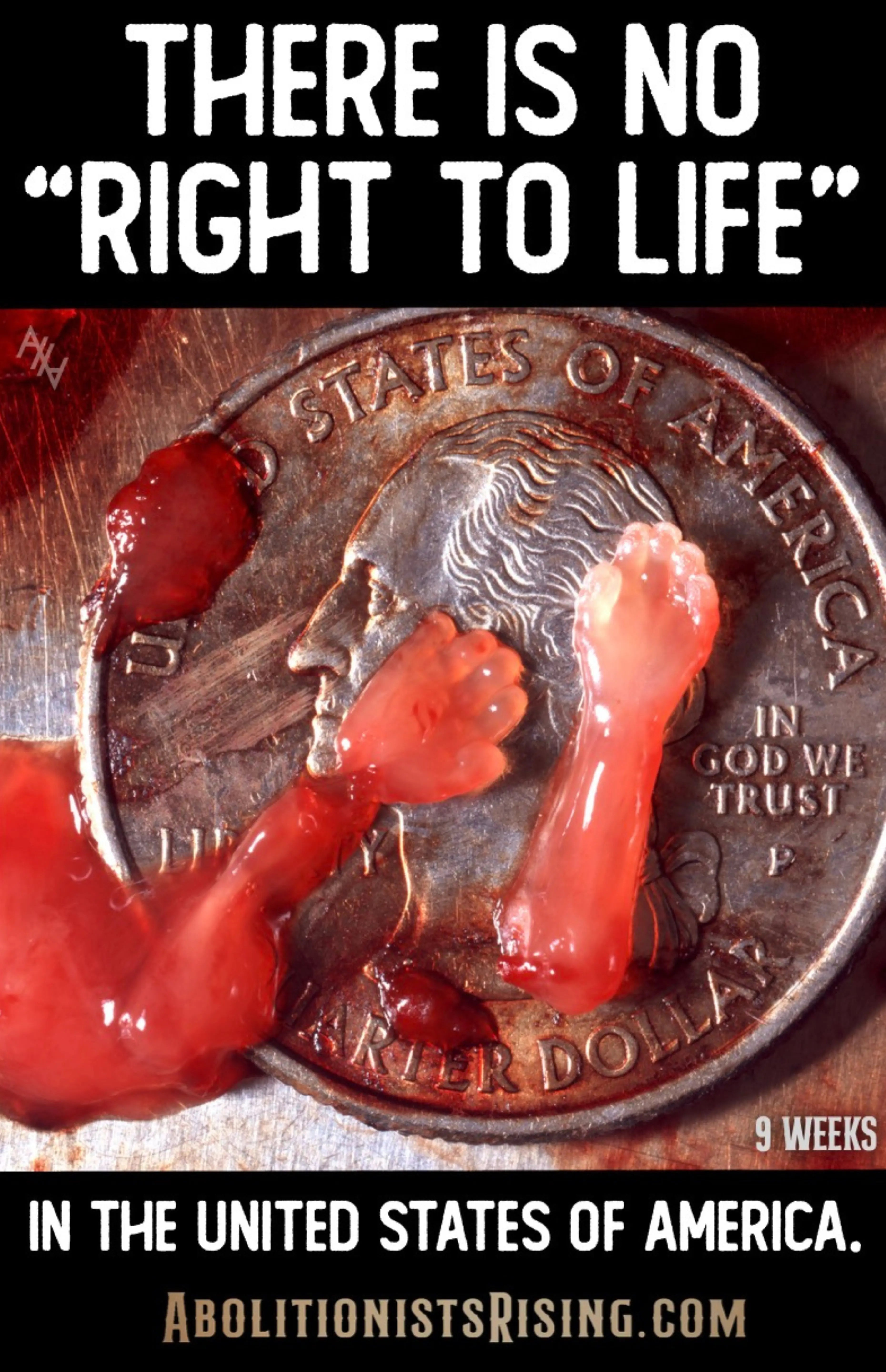 There Is No Right To Life Sign Abolitionists Rising Store 