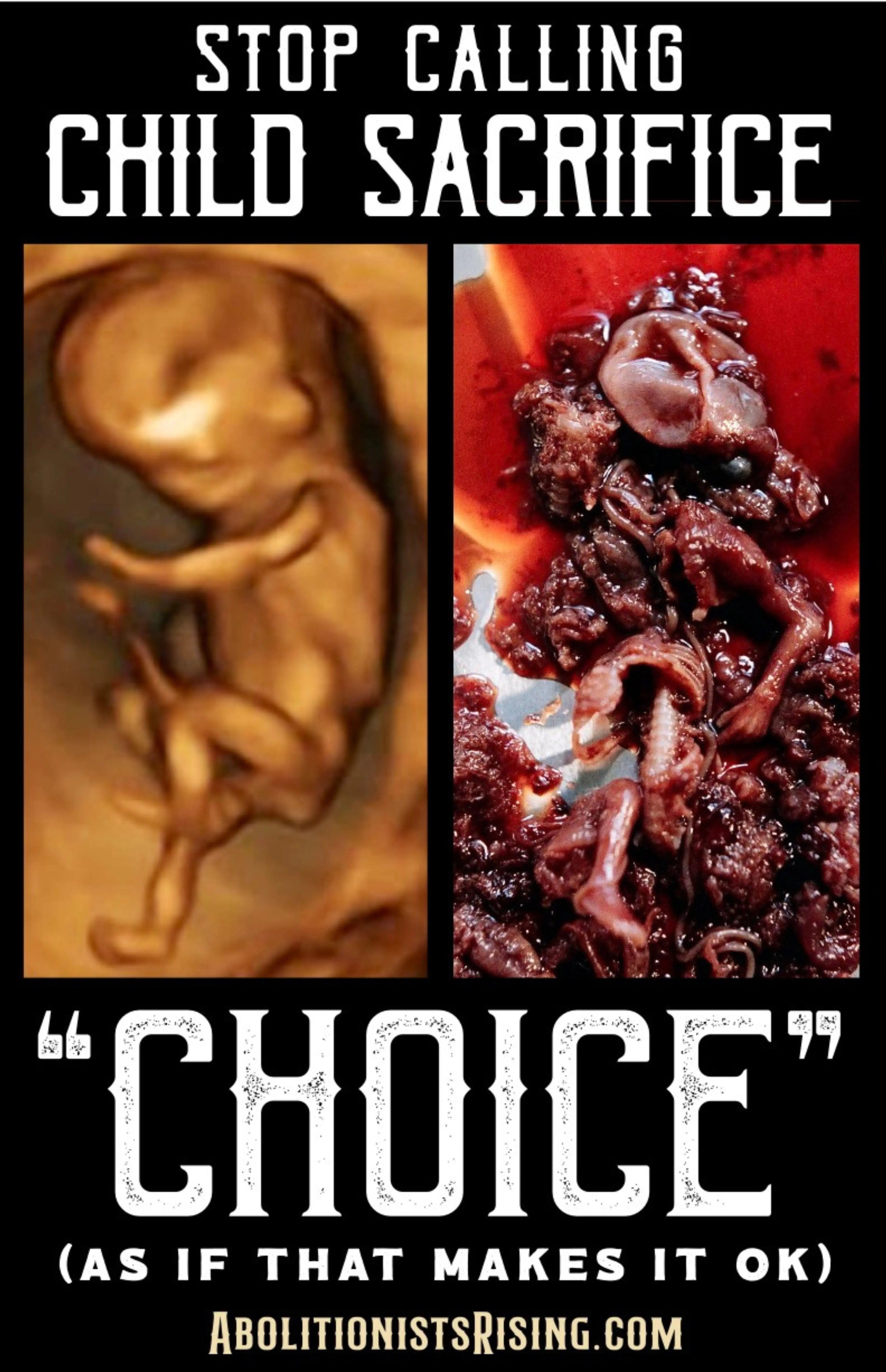 Stop Calling Child Sacrifice Choice Sign Abolitionists Rising Store 